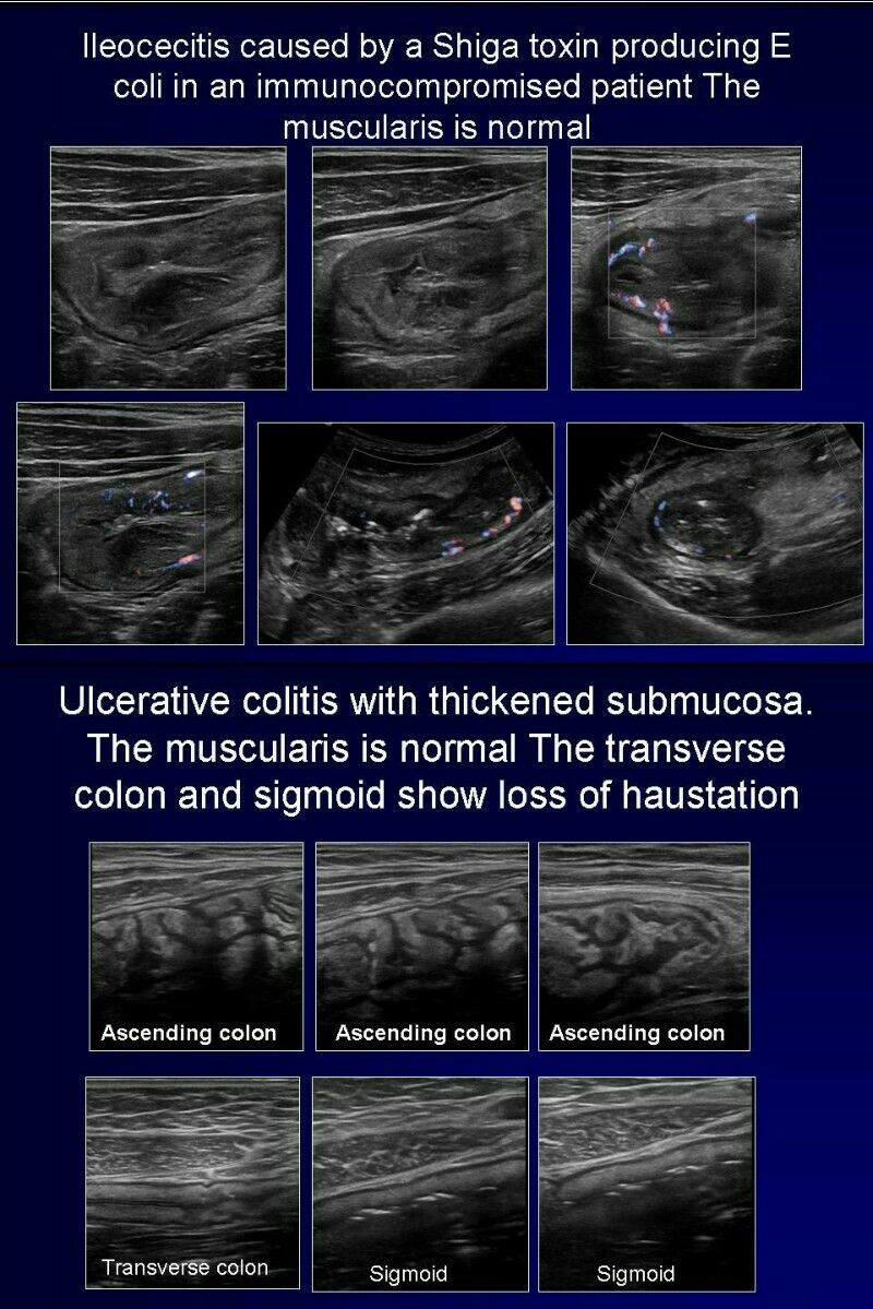 Medical Imaging Worksheet Answers